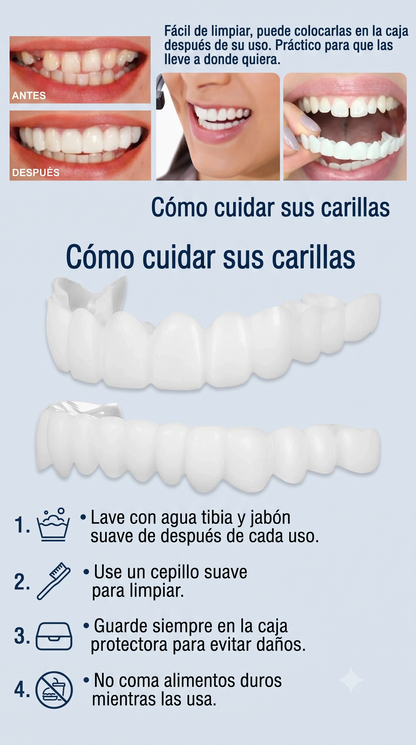 Carillas Dentales Snap Smile – Sonrisa Perfecta en Segundos