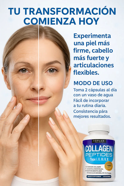 Collagen Peptides